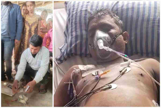 डायलिसिस के दौरान काटा युवक का जीभ, परिजनों ने चंदा मांगकर कराया इलाज