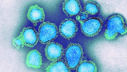H3N2 वायरस बढ़ते देख आरजेडी अलर्ट, बिना मास्क एंट्री निषेध