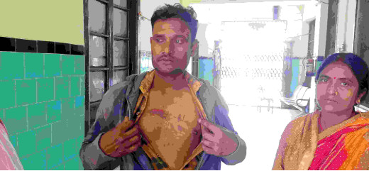 मामूली विवाद बना हिंसक, जमकर चले ईंट पत्थर और चाकू, एक युवक की मौत