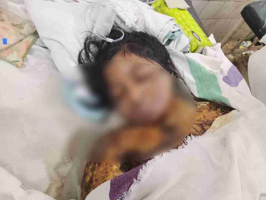 ससुराल में जलायी गई महिला की एसकेएमसीएच में मौत, पुलिस पर लापरवाही का आरोप