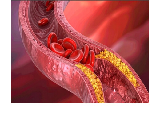 आयरन की कमी बनाती है शरीर को बेजान, जानें रोज कितनी मात्रा है जरूरी 