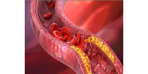 आयरन की कमी बनाती है शरीर को बेजान, जानें रोज कितनी मात्रा है जरूरी 