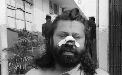 आशुतोष ब्रह्मचारी पर जानलेवा हमला, नाक काटने की कोशिश का आरोप