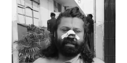 आशुतोष ब्रह्मचारी पर जानलेवा हमला, नाक काटने की कोशिश का आरोप